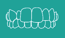 Crossbite