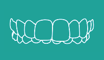 Overbite
