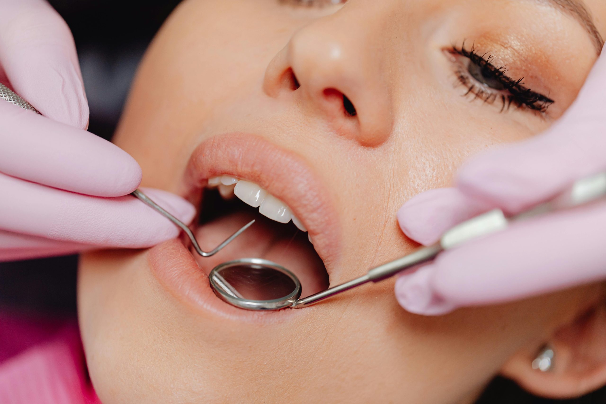 Recovery Time And Care After Wisdom Teeth Removal