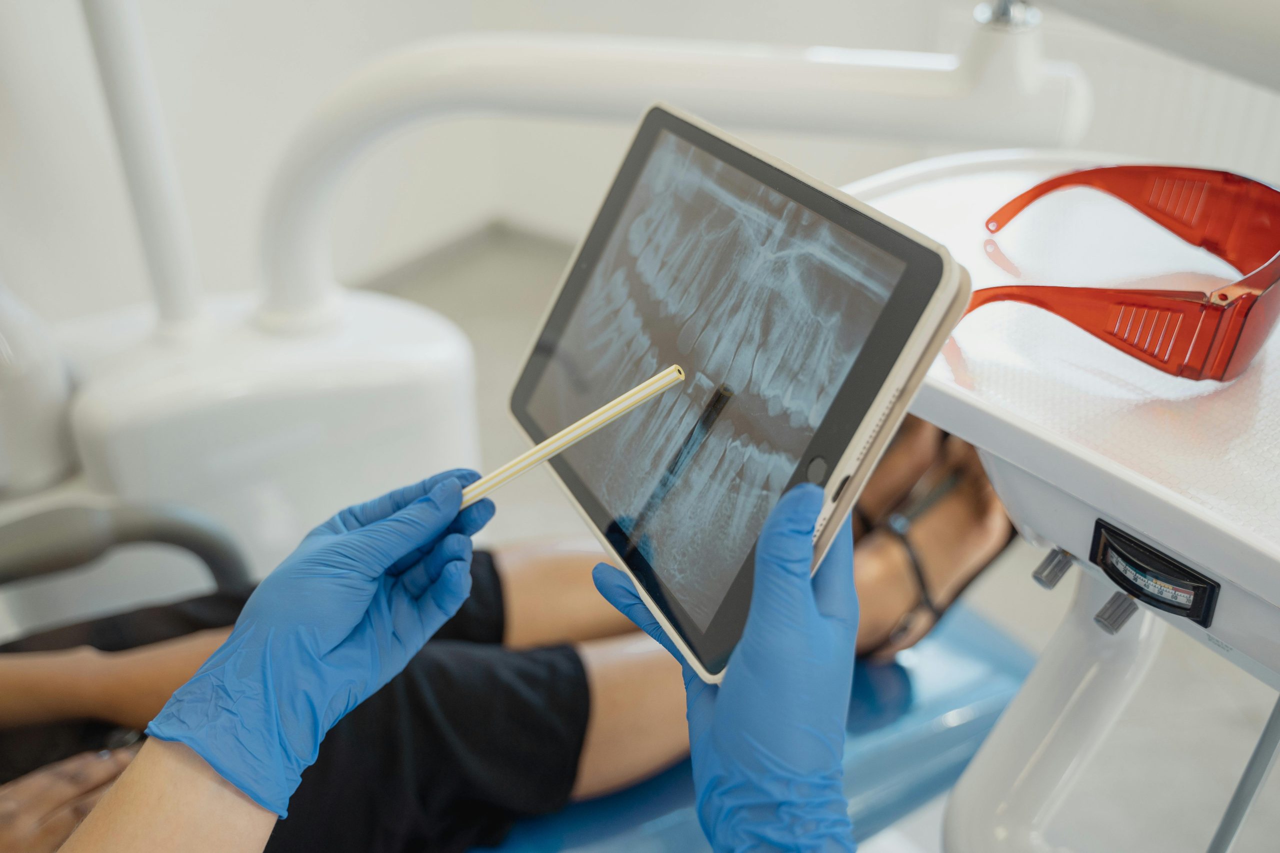 Root Canal Treatment: Is It Painful? – Niddrie Dental Clinic